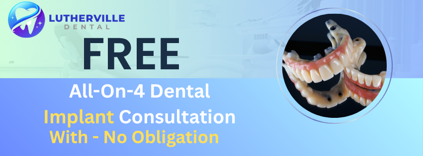 All-on-4 Dental Implants Offer