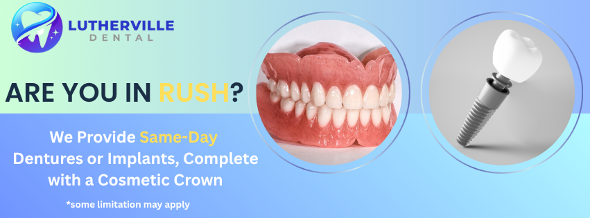 Complete Denture with Cosmetic Crown Offer